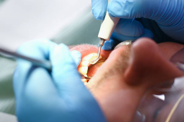 Best Dentist for Severe Toothache  in Bennington, NE
