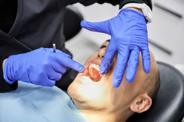 Best Dentist for Tooth Abscess  in Bennington, NE