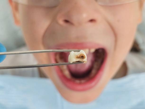 Best Broken Tooth Emergency  in Bennington, NE